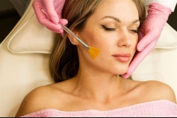 Glycolic Peel Treatment in Newport Beach for Brighter, Smoother Skin