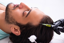 Hair Transplant Options and How To Find A Doctor Near You