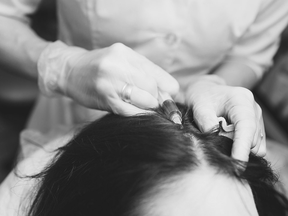 Best Hair Transplant Method