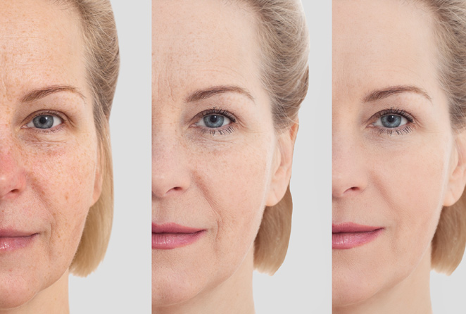 What Skin Tightening Options Are Best for You? - blog